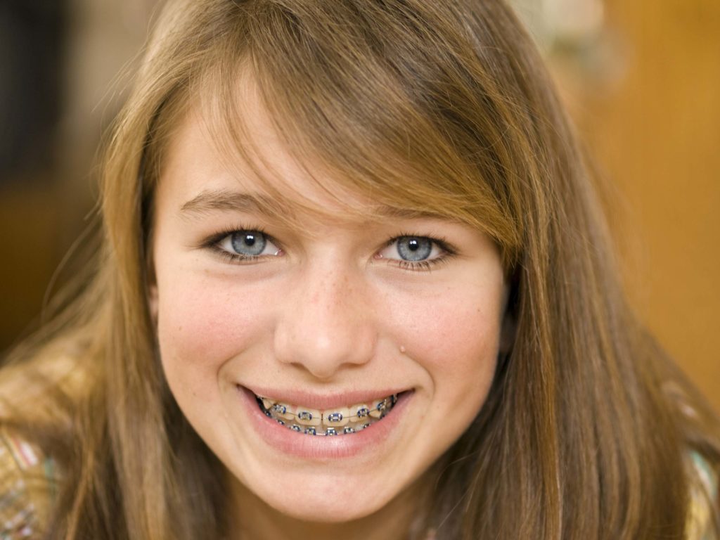 Mentor Orthodontics